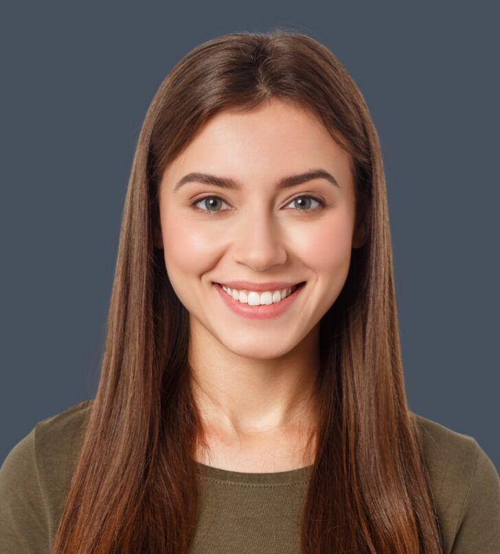 Veneers
