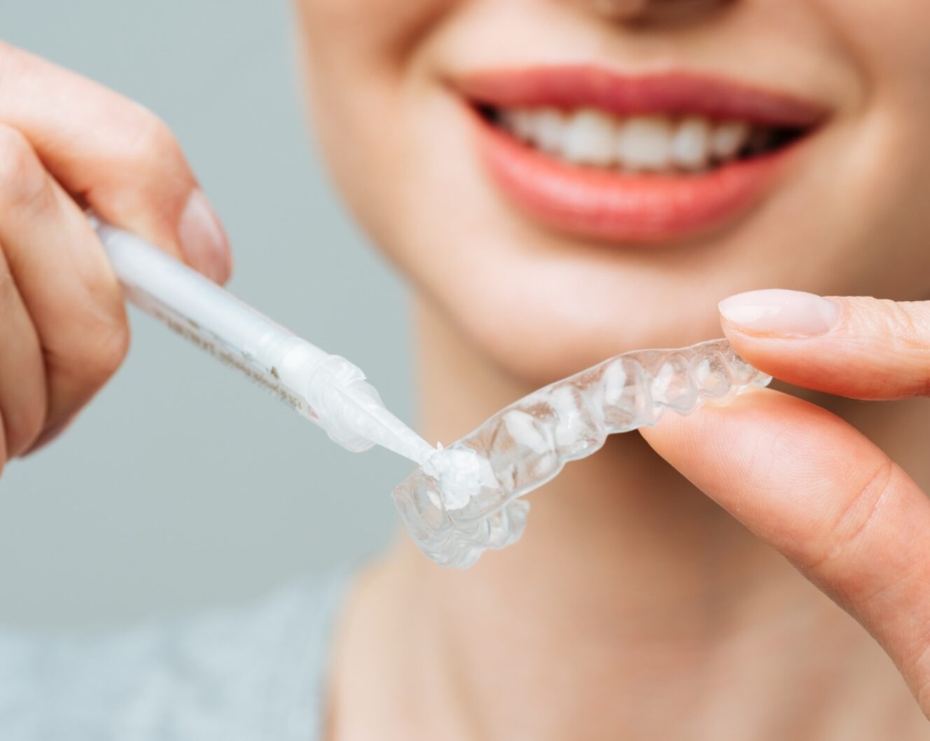 Teeth Whitening